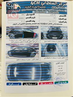 هيونداي كونا